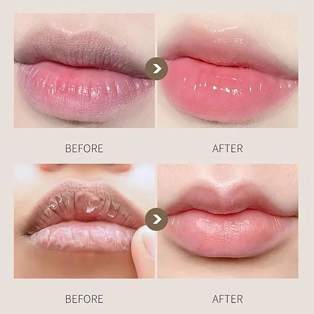Watermelon Sleeping Lip Mask,Bee Lip Balm Care(Watermelon)