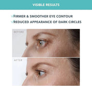 Foreo IRIS Firming PM Eye Serum - Retinol - Mushroom Extract - Vitamin E - Bakuchiol - Travel size Treatment Products - Da...