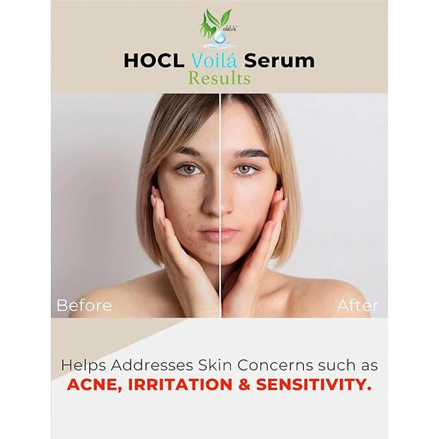 VoilaVe Pure Hypochlorous Acid Serum, Anti-Wrinkle Hypochlorous Acid Face Serum for Redness - Reduce Dryness, Skin Irritat...
