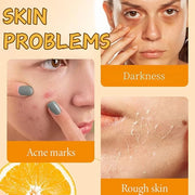 Skincare Kit Vitamin C Women Gifts - Skin Care Set Antioxidant - 5PCS Teen Skin Care Kit - Moisturizing Skincare Set - Ski...