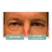 Instant Eye Lift - Eye Cream to Visibly Reduce Fines Lines, Crow's Feet, Puffiness, and Dark Circles Instantly and Over Ti...