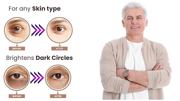 IE - 24K Gold Eye Mask - 16 Pairs for Rejuvenated Eyes - Reduces Dark Circles, Puffiness, Fine Lines, and Wrinkles. - Prod...