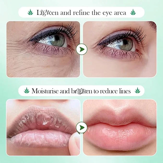 YP 10 Pairs Aloe Vera Under Eye Patches and Moisturizing Lip Mask Set - 10 Pcs Aloe Vera Under Eye Patches, Refines Eye ma...
