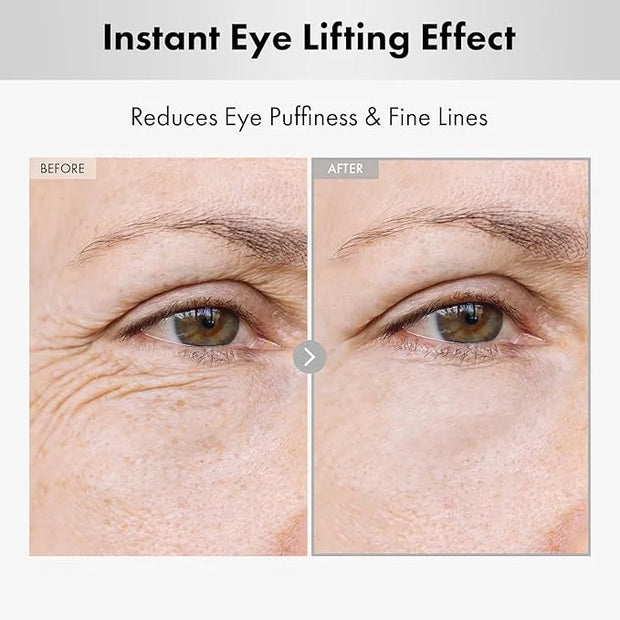 Hyaluron Lifting Eye Cream, Hyaluronic Acid, 5% arbutin, Niacinamide for Puffy Eyes, Dark Spot and Fine Lines, Hydrating U...