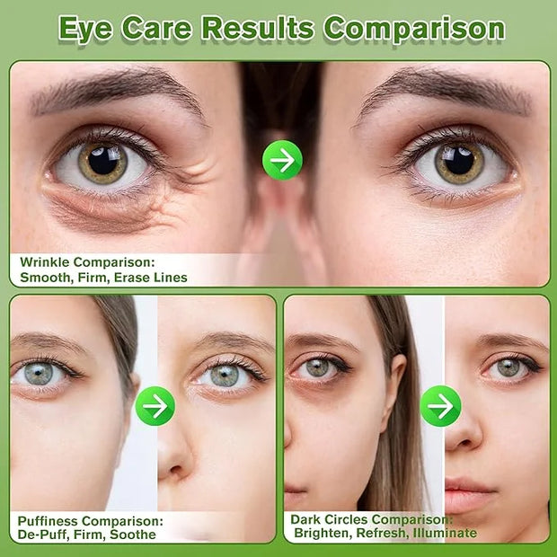 Aloe Vera Eye Gel Patches 2 Pack 120 PCS, Soothing & Hydrating, Reducing Dark Circles and Puffiness, Collagen-Infused Eye ...