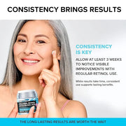SimplyVital Collagen Face Moisturizer - Anti-Aging Retinol Cream for Face, Neck & Décolleté with Hyaluronic Acid - Made in...