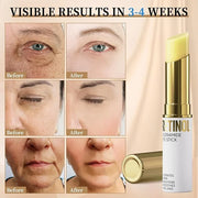 Retinol Eye Stick, Eye Cream for Dark Circles and Puffiness, Hydration and Brightening Eye Balm, Under Eye Cream Anti Agin...