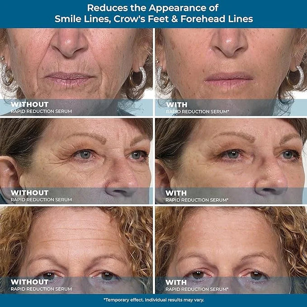 Plexaderm rapid reduction eye serum
