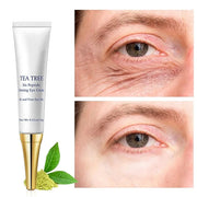 Eye Cream for Dark Circles Under Eye Cream for Puffiness and Bags Tea Tree Six Peptide Fiming Anti-Aging Eye Cream for Wri...