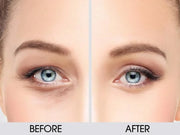 Classic Upper Eyelid Revitalizing Eye Cream 1 oz. - Product Image