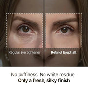 Retinol Eyebag Cream for Puffiness, Dark Circles & Fine Lines, Wrinkle, EGF Anti-Aging Under Eye Moisturizer with Niacinam...