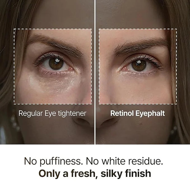 Retinol Eyebag Cream for Puffiness, Dark Circles & Fine Lines, Wrinkle, EGF Anti-Aging Under Eye Moisturizer with Niacinam...