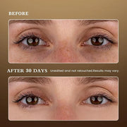 Puffy Eyes Smoothing Under Eye Patches, Caffeine Eye Masks for Wrinkles and Dark Circles, Undereye Bags, Brightening Skinc...