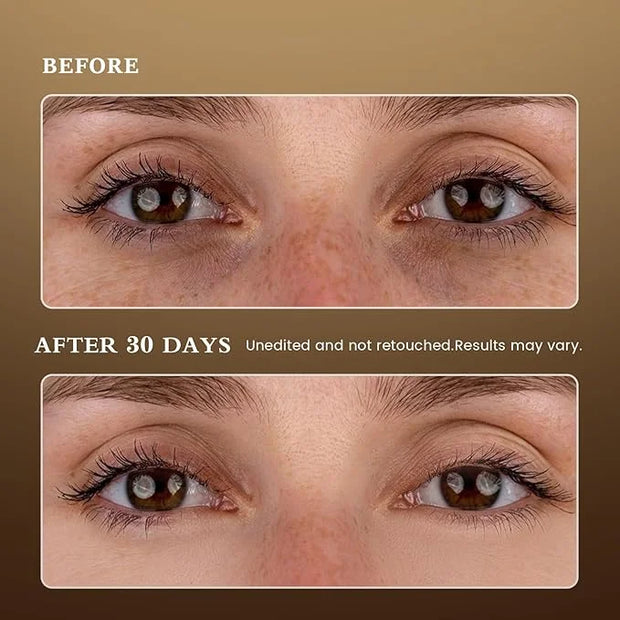 Puffy Eyes Smoothing Under Eye Patches, Caffeine Eye Masks for Wrinkles and Dark Circles, Undereye Bags, Brightening Skinc...
