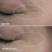 DRMTLGY Dark Circles Bundle - Medium: Luminous Eye Corrector SPF 41 & HPR Eye Cream - Product Image