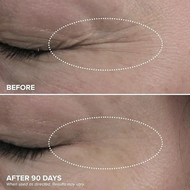 DRMTLGY Dark Circles Bundle - Medium: Luminous Eye Corrector SPF 41 & HPR Eye Cream - Product Image