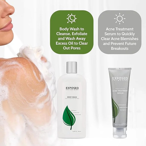 Exposed Skin Care Body Acne Kit – Dual Acne Treatment Serums + Body Wash and Exfoliating Body Cloth – Powerful System Elim...