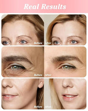 Retinol Eye Stick Under Eye Cream Anti Aging Eye Balm Reduces Fine Lines and Dark Circles - Product Image