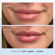 First Aid Beauty - Ultra Repair Lip Balm, Instant Hydration and Moisture for Soft, Supple & Plump Lips, Concentrated Formu...