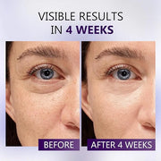 Eye Serum for Dark Circles and Puffiness, Caffeine Eye Serum Infused Collagen and Niacinamide with Ice Globe for Puffy Eye...