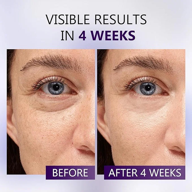 Eye Serum for Dark Circles and Puffiness, Caffeine Eye Serum Infused Collagen and Niacinamide with Ice Globe for Puffy Eye...