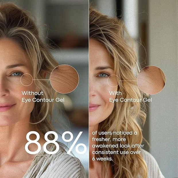 Under Eye Gel with Peptides, Niacinamide, Vitamin E, Targets the Appearance of Eye Bags & Visibly Reduces Dark Circles, Re...