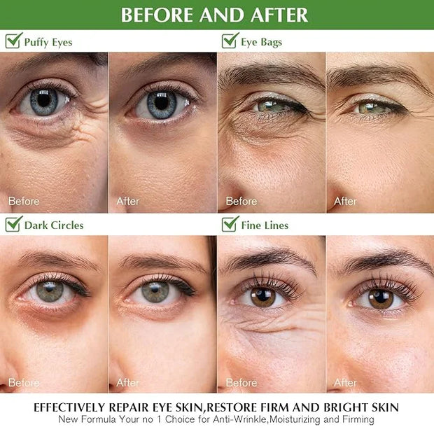 Under Eye Patches for Dark Circles: 30 Pairs Green Tea Eye Gels Pads - Reduce Eye Bags, Wrinkles & Puffy - Skin Treatment ...