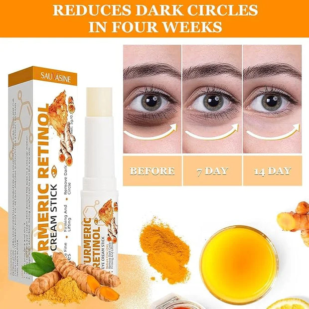 2PCS Eye Bags,Eye Balm Stick Wrinkles,Hydrating for Dark Circle,For Puffiness and Bags Reduces Fine Lines - Product Image