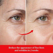 5% Caffeine Eye Cream Anti Aging with 360 Rollerball, Reduce Wrinkles and Dark Circles, Under Eye Cream For Women and Men ...
