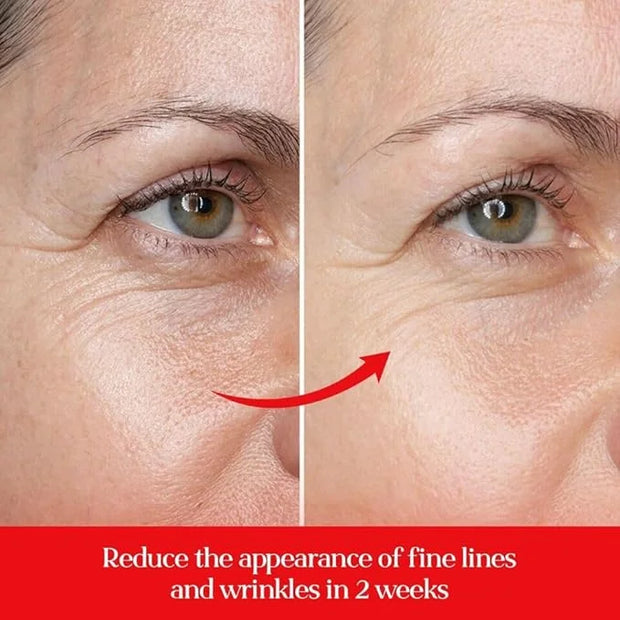 5% Caffeine Eye Cream Anti Aging with 360 Rollerball, Reduce Wrinkles and Dark Circles, Under Eye Cream For Women and Men ...
