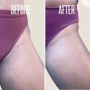 Save 14% on The Skin Care Solution For Dark Spots, Razor Bumps, Ingrown Hair & Razor Burns – Includes Our Ultra Potent Bri...