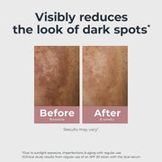Eucerin Radiant Tone Dual Serum Dark Spot Corrector, Dark Spot Serum with Thiamidol and Hyaluronic Acid, Helps Visibly Red...