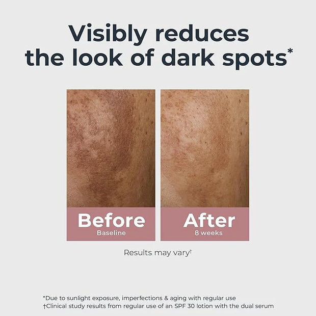 Eucerin Radiant Tone Dual Serum Dark Spot Corrector, Dark Spot Serum with Thiamidol and Hyaluronic Acid, Helps Visibly Red...