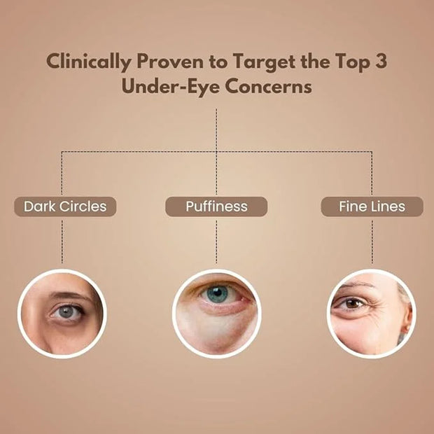 Under Eye Gel – Reduces Puffiness, Dark Circles & Eye Bags – With Hyaluronic Acid, Niacinamide & Marine Botanicals – Light...