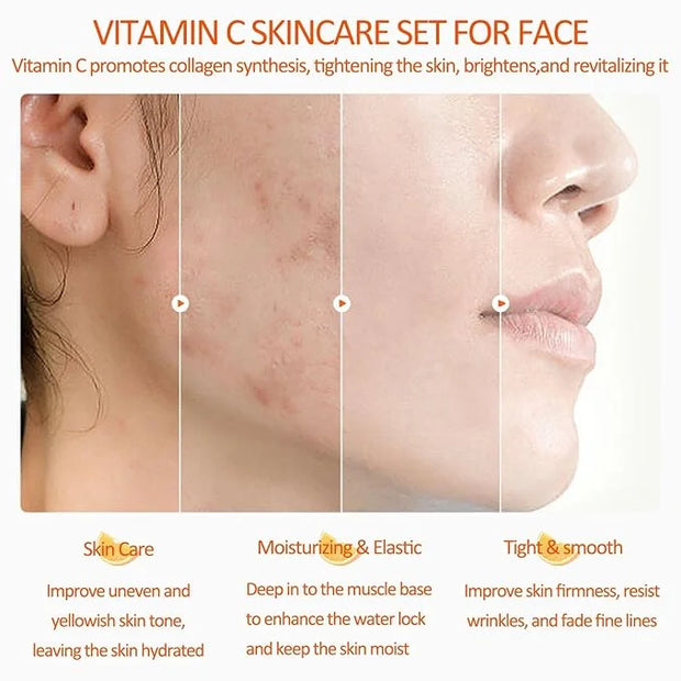 Vitamin C Skin Care Set, Girls Skincare Gift Set With Cleanser, Toner, Face Serum, Face & Eye Cream, Skin Care For Teens 1...