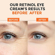 Retinol Eye Cream for Dark Circles and Puffiness, Hyaluronic Acid Serum for Face Anti Aging, Fine Lines, Dark Spots, & Dry...