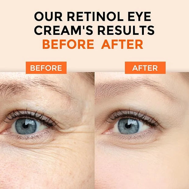 Retinol Eye Cream for Dark Circles and Puffiness, Hyaluronic Acid Serum for Face Anti Aging, Fine Lines, Dark Spots, & Dry...