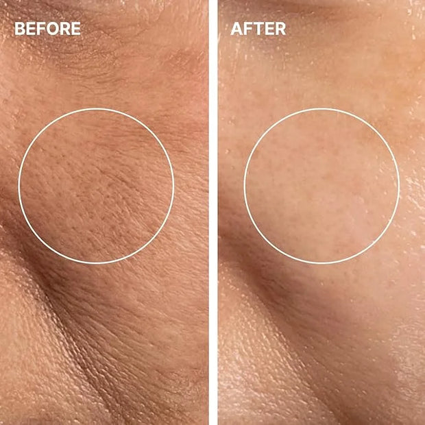 THOME Glow Sealer Mask Refill Set | 6 Sheets of Ultra-high Hydration for Chemical G-Peel at home - Product Image
