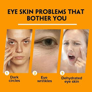 2PCS Retinol Eye Stick for Anti Aging, Turmeric Eye Cream for Dark Circles and Puffiness Fine Lines Moisturizer Under Eye ...