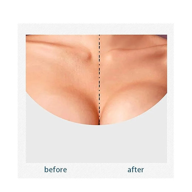 VolksRose Face & Chest Wrinkle Patches, Reusable Silicone Patches for Brow Lift, Wrinkle Smoothers, Cleavage - Overnight A...
