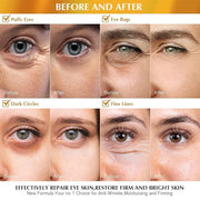 Enaskin Naturals Under Eye Patches Dark Circles Under Eye Masks for Puffiness - 24K Gold Eye Gel Pads Retinol Collagen Hya...