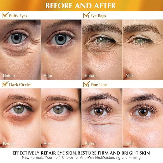 Enaskin Naturals Under Eye Patches Dark Circles Under Eye Masks for Puffiness - 24K Gold Eye Gel Pads Retinol Collagen Hya...