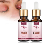 Chalazion Eye Treatment For Blepharitis, 2 PCS Moisturize Eyelids Serum and Chalazion Remover, Gentle Under Eye Relief Ser...
