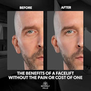 Beverly Hills Instant Facelift Anti Aging Eye Serum Treatment & Mens Instant Facelift Bundle with Discount - For Dark Circ...
