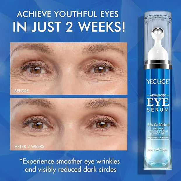 Eye Serum for Dark Circles and Puffiness, Under Eye Serum with 5% Caffeine Anti Aging Smooths fine lines and wrinkle appea...