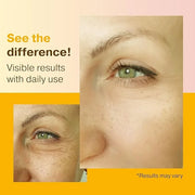 Double Size (2OZ) Super Vitamin C Serum for Face w/Niacinamide Serum, 5% Vitamin C Face Serum w/Hyaluronic Acid, Resveratr...