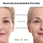 Retinol Eye Cream for Anti-Aging & Wrinkles - Firming & Repair Under Eye Serum with Retinol, Niacinamide, Hyaluronic Acid,...