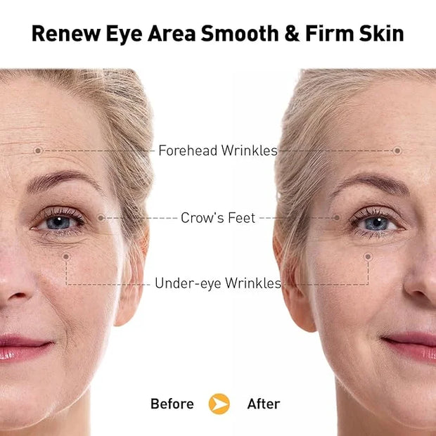 Retinol Eye Cream for Anti-Aging & Wrinkles - Firming & Repair Under Eye Serum with Retinol, Niacinamide, Hyaluronic Acid,...