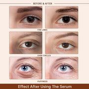 Caffeine Solution 5% + EGCG Eye Serum for Skin Care Caffeine Eye Hyaluronic Acid Reducing Puffiness and Dark Circles, Niac...