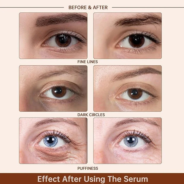 Caffeine Solution 5% + EGCG Eye Serum for Skin Care Caffeine Eye Hyaluronic Acid Reducing Puffiness and Dark Circles, Niac...